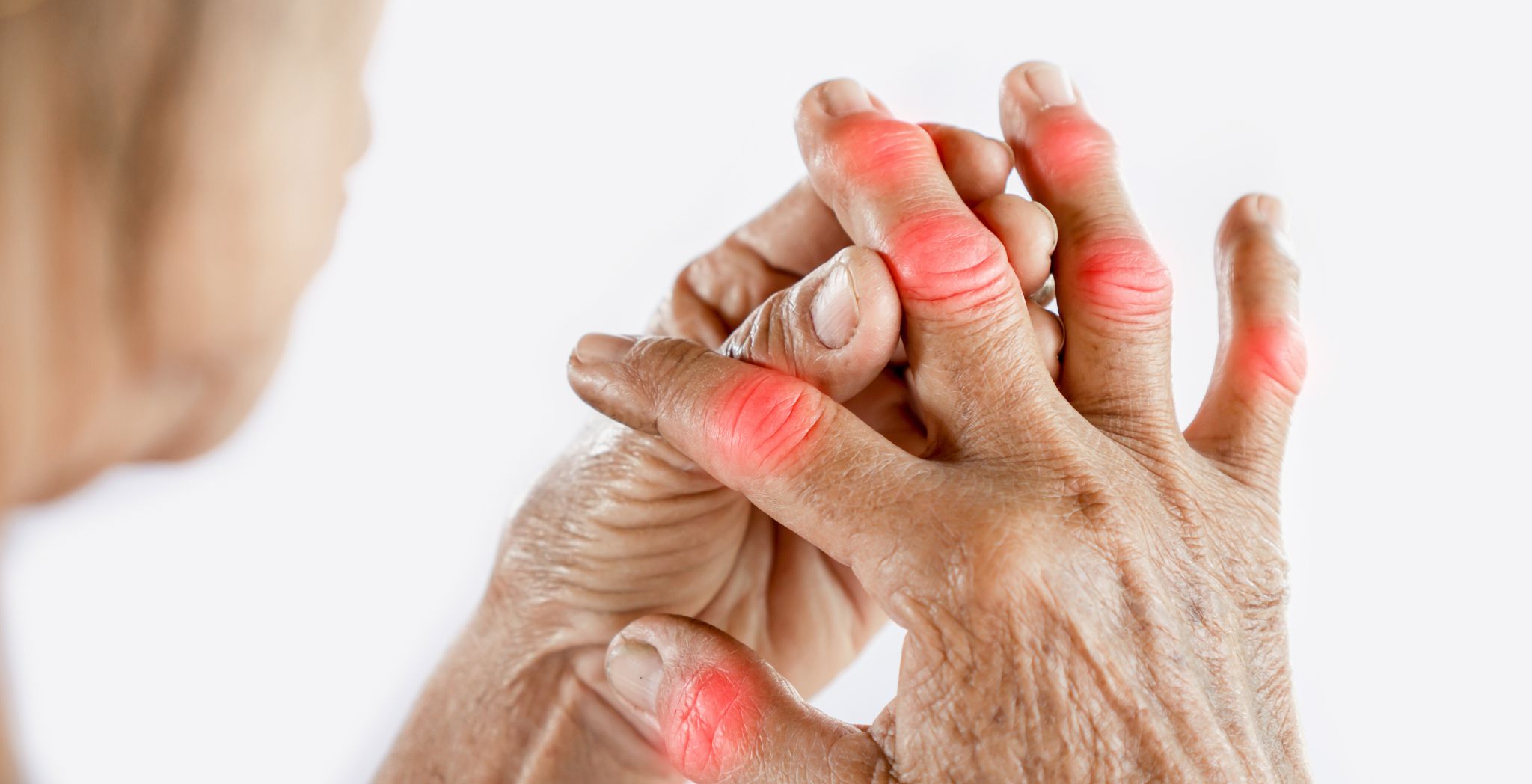 Will cracking fingers cause arthritis, Finger cracking and arthritis, Does knuckle cracking cause arthritis, Cracking joints arthritis myth, Finger popping and joint health, Knuckle cracking side effects,